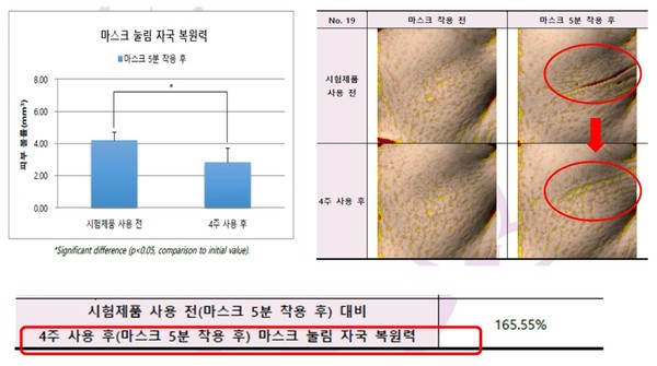 '인현진 윤단 시그니처' 피부 복원력 시험 결과